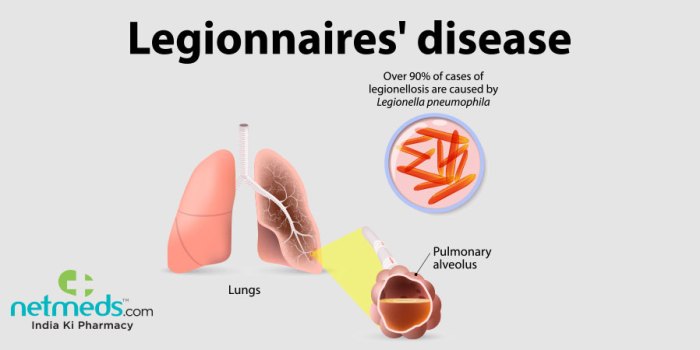 Legionnaires' disease