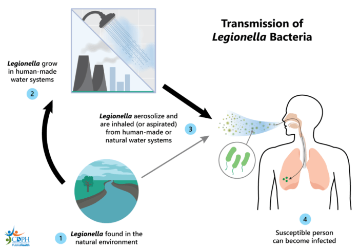 Legionnaires' disease